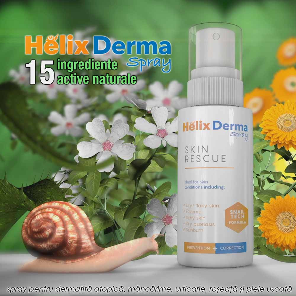Helix Derma Spray 100ml pentru urticarie, mancarime, roseata, dermatita atopica, piele uscata